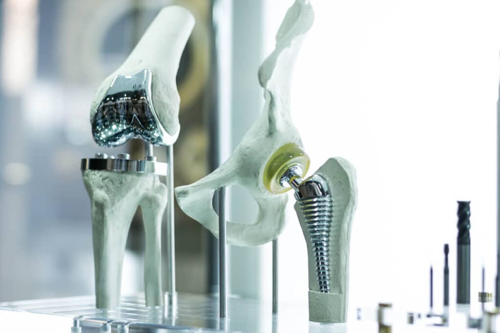 Model of a knee replacement implant.
