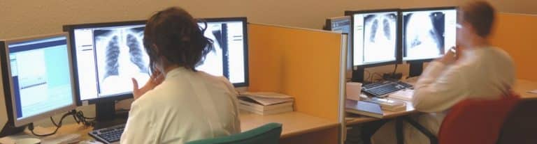 doctors analyzing lung x-rays on computers