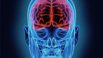 X-Ray of Skull and Brain